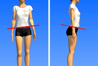 Supporto plantare - prima e dopo